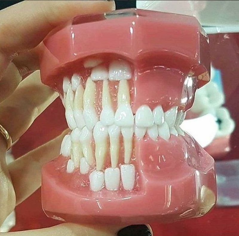 Как происходит развитие зубов у человека